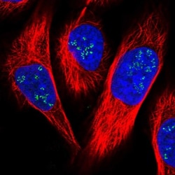 FAM111A Antibody, Novus Biologicals 0.1mL; Unlabeled:Antibodies, Polyclonal